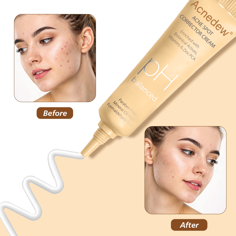Acnedew Antiacne Spot Corrector - Image 4