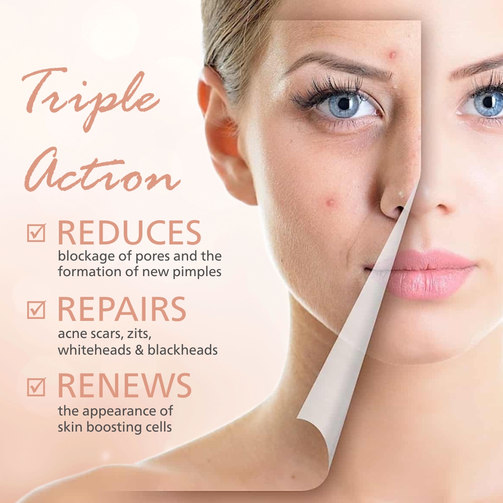 Maxisoft Calamine Lotion - Image 4